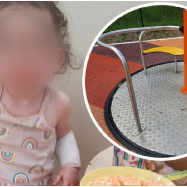 Девојче се здоби со изгореници од прв степен во парк за деца: Мајка ги предупредува родителите да се чуваат од жешки метални делови (ФОТО)