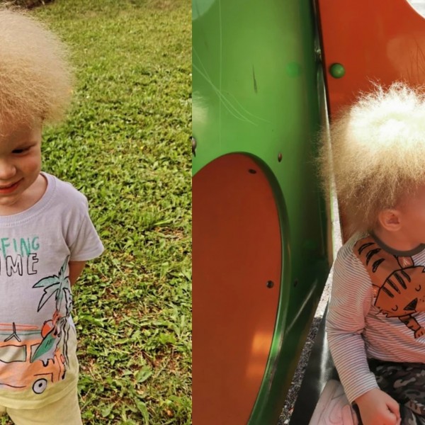 Лав од Крагуевац е едно од 100-те деца во светот со ваква коса: Има синдром на „палава коса“ и ги импресионира сите со слаткиот изглед