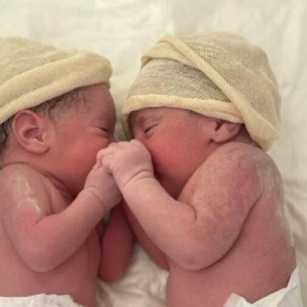 Чудесното „сирена породување“ се случува еднаш во 80 000 случаи: Овие неверојатни близнаци го изненадија целиот медицински персонал